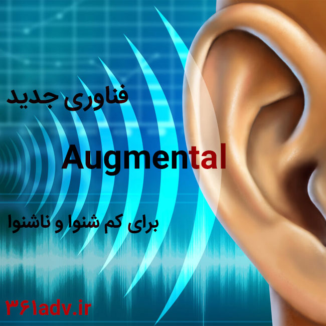 فناوری جدید Augmental برای کم شنوا و ناشنوا